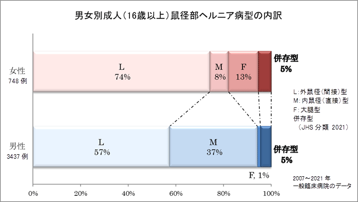 成人の鼠径ヘルニアについて